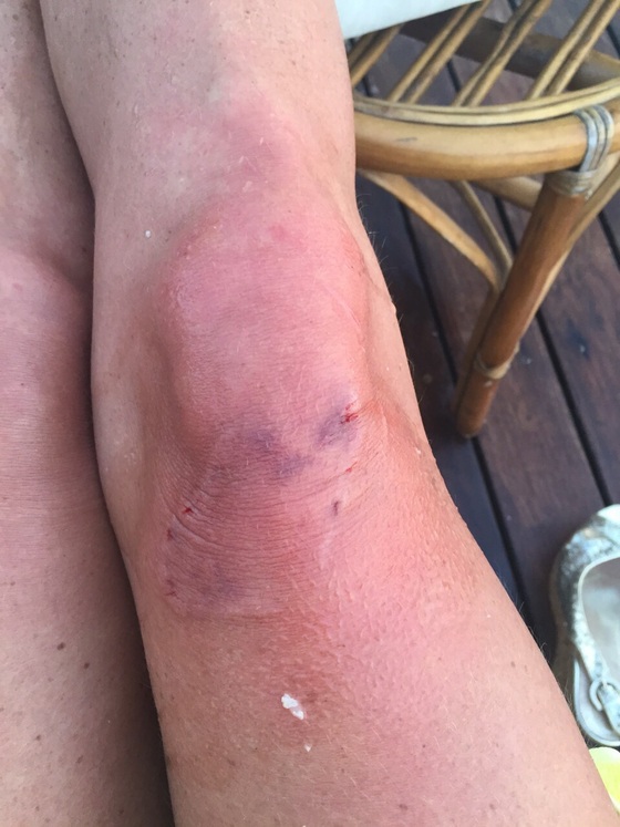 Анастасия Волочкова