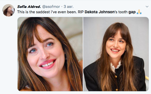 Дакота Джонсон позбулася щербинки між зубами