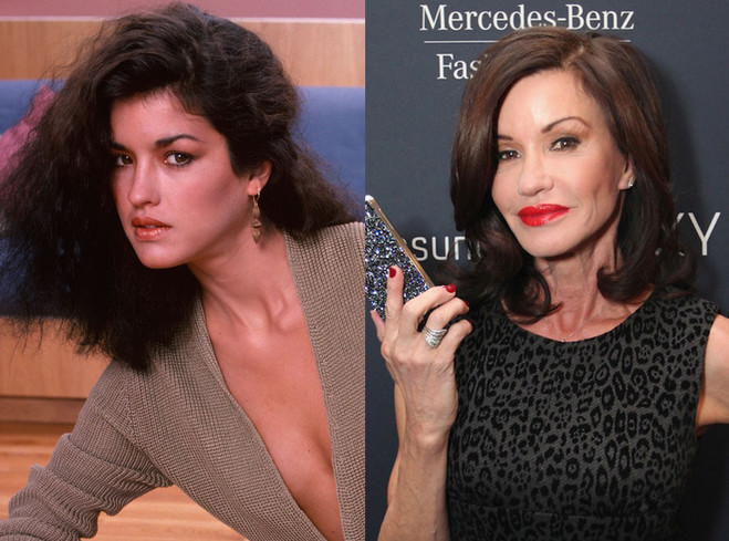 Звезды до и после пластики