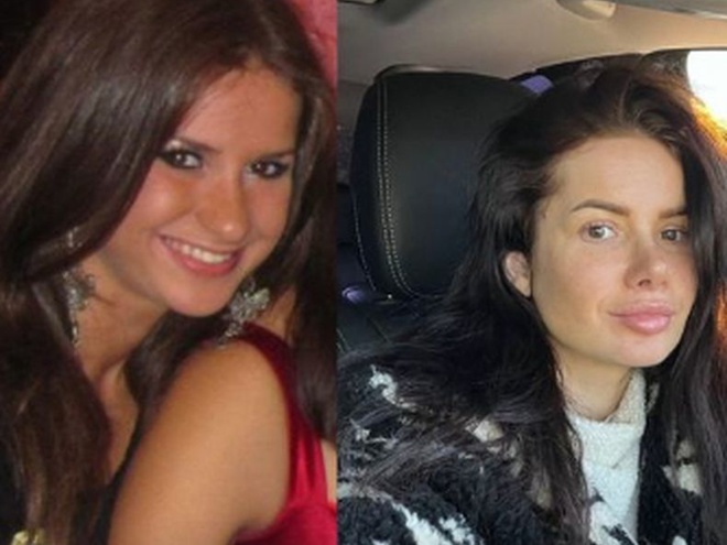 Блогерка Шаманська розсекретила, які пластичні операції робила