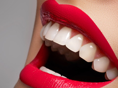 Як відбілити зуби