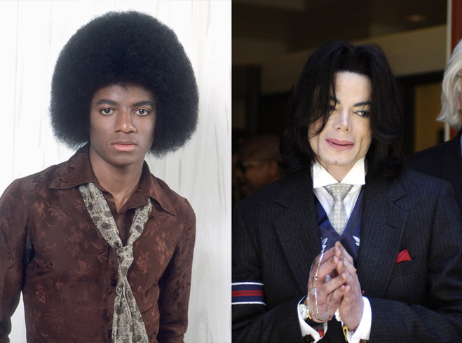 Звезды до и после пластики