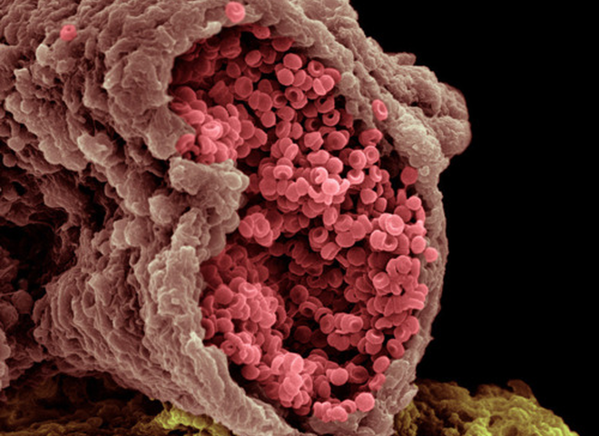 Як виглядає наше тіло під мікроскопом: 25 дивовижних фотографій