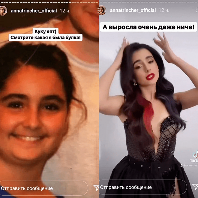 Анна Тринчер