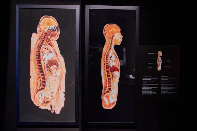 "Вселенная тела": 5 интересных фактов о всемирно известной выставке