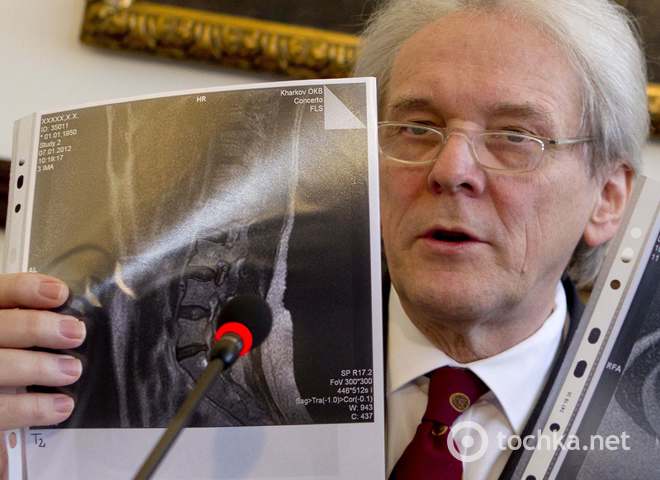 Немецкие врачи показали МРТ спины Тимошенко
