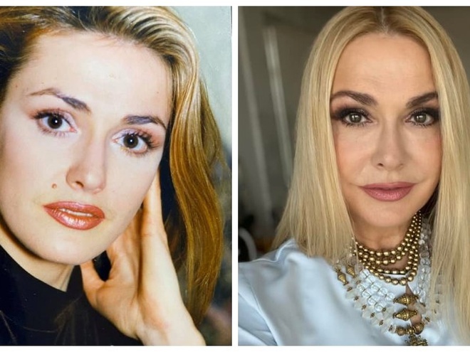 Сумська вперше зізналася, чому видалила свою фірмову родимку на обличчі