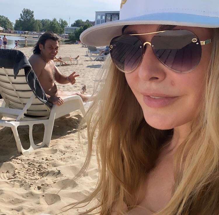 Ольга Сумская удалила фирменную родинку на лице