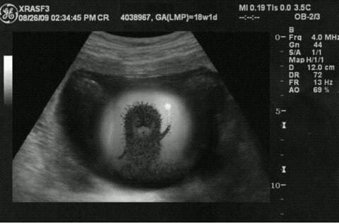 Вот он, Ёжик в тумане
