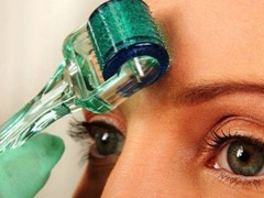 Что такое мезороллер?