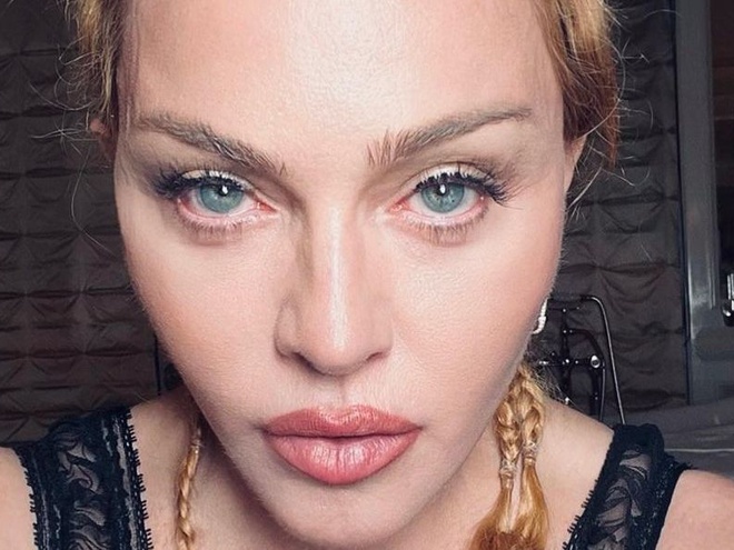 "10 тыс. фильтров": Мадонна озадачила фанов фото, на котором выглядит 12-летней девочкой