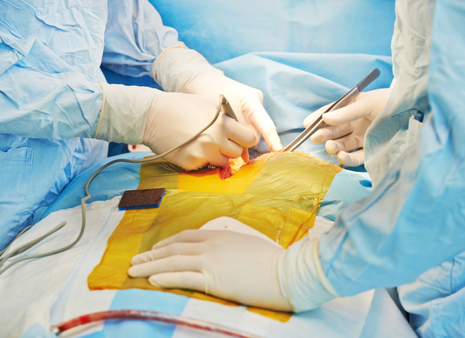 Трансплантологія в Україні