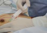 Маммопластика в Центре Эстетической Хирургии