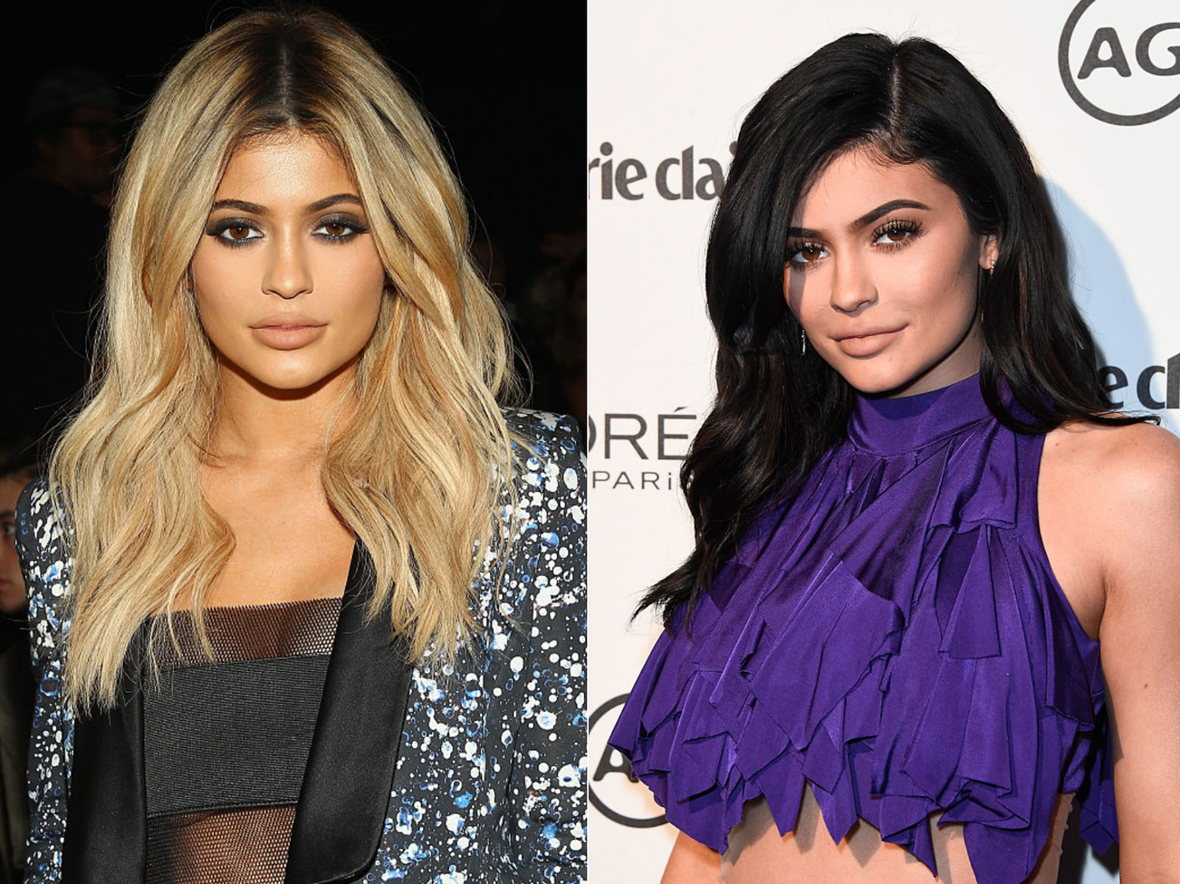 Кайлі Дженнер до і після пластики: історія змін