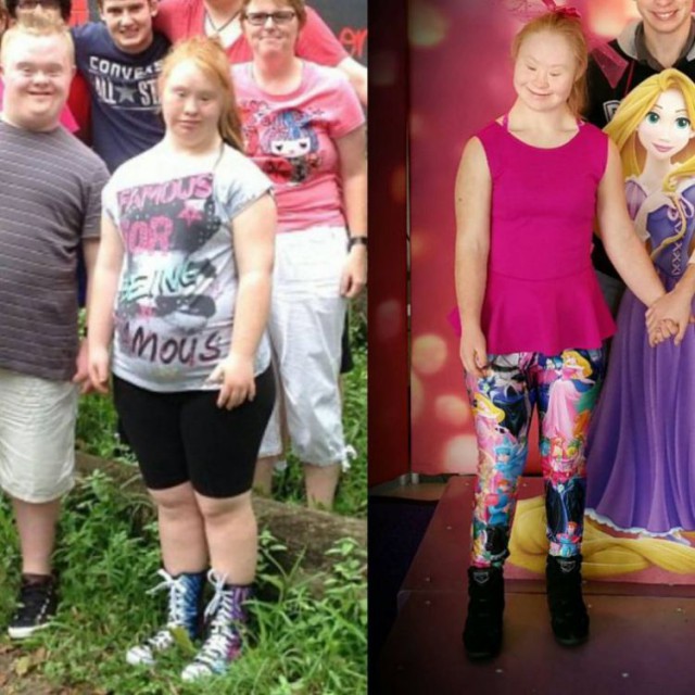 Девушка с синдромом Дауна стала моделью