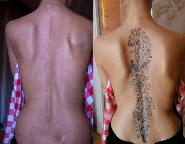 Татуировки вместо шрамов