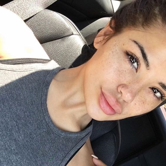 Штучні веснянки на обличчі