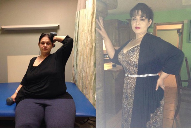 Майра Розалес - женщина, которая похудела на 408 кг