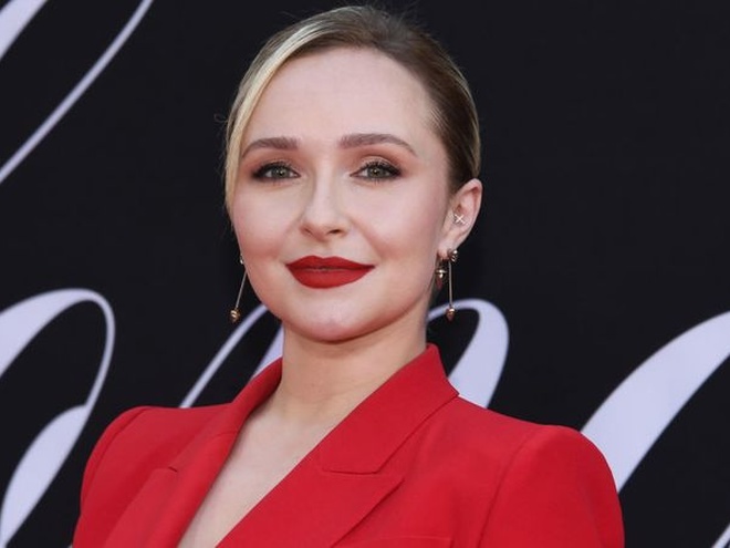 Колишня наречена Кличка  Гейден Панеттьєр зізналася, що робила пластику