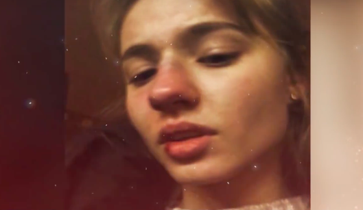 Бывший парень Лизы Василенко сломал ей нос