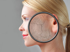 Як позбутися від пігментних плям на обличчі