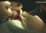 Ринопластика отзывы  http://estheticcenter.ru