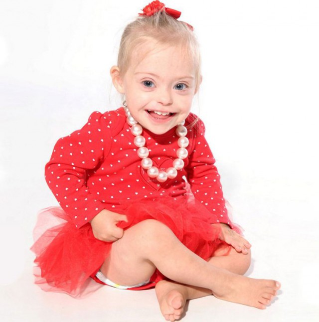 Улыбка 2-летней малышки Конни-Роуз с синдромом Дауна покорила мир моды