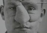 Ринопластика до и после  http://estheticcenter.ru