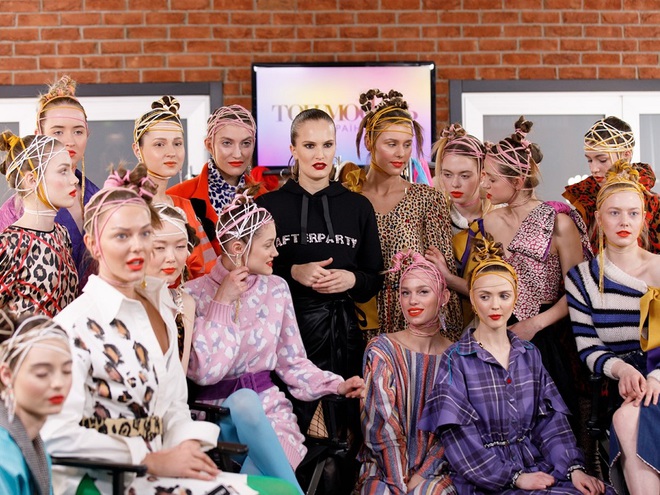 Участнице "Топ-модели по-украински" сделали операцию