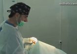 Ринопластика в Москве http://estheticcenter.ru