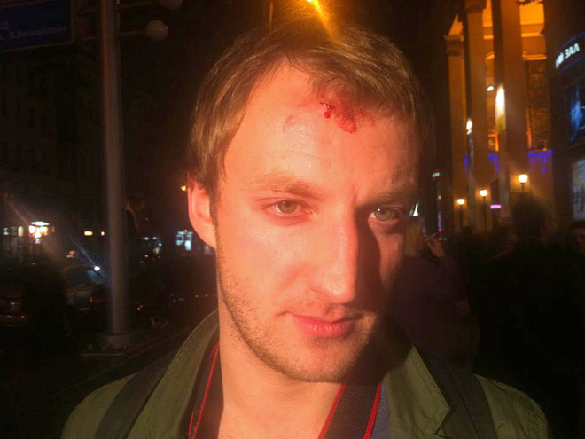 Охранна Киркорова разбила голову фотографу в Киеве