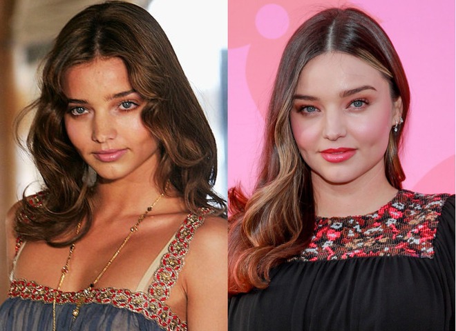 Тогда и сейчас: как изменились ангелы Victoria's Secret