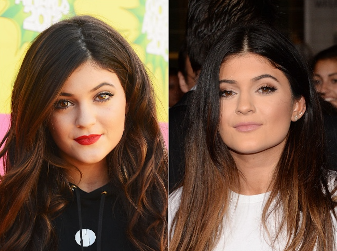 Кайлі Дженнер до і після пластики: історія змін