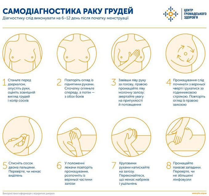 Самодіагностика молочної залози