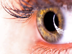 Як розпізнати і лікувати глаукому