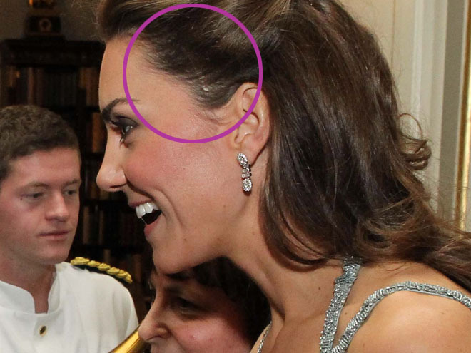 Кейт Міддлтон