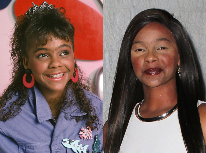 Звезды до и после пластики