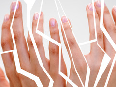 Что делать, если трескается кожа на руках