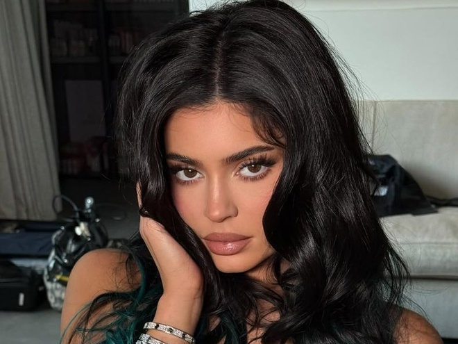 Кайлі Дженнер заявила, що лікувалася від болю в спині стовбуровими клітинами