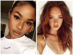 Веснушки: как избавиться