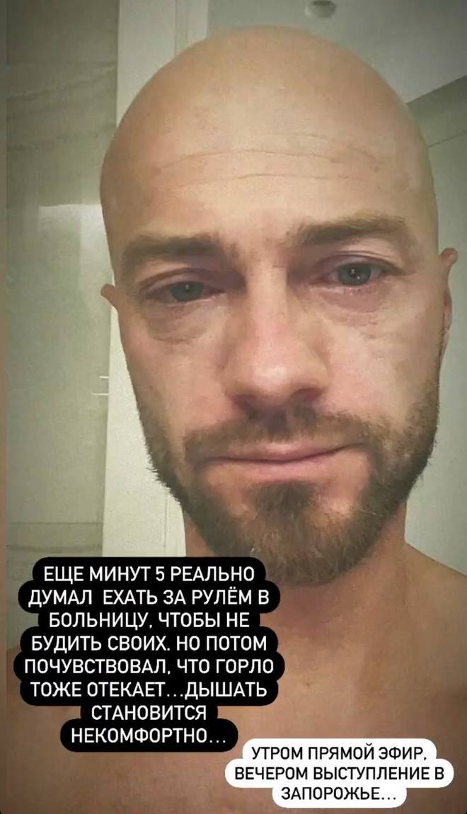 Влад Яма об аллергической реакции после ужина в ресторане