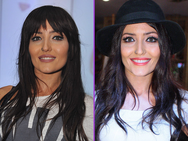 Аня Добрыднева увеличила губы