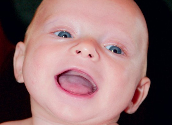  Як лікують зубки малюків 