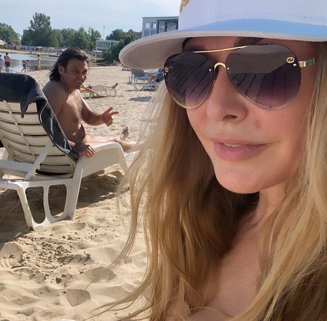 Ольга Сумская удалила фирменную родинку на лице