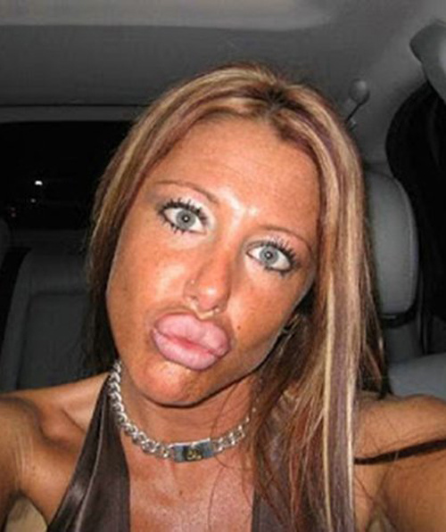 Губастые красавицы из социальных сетей