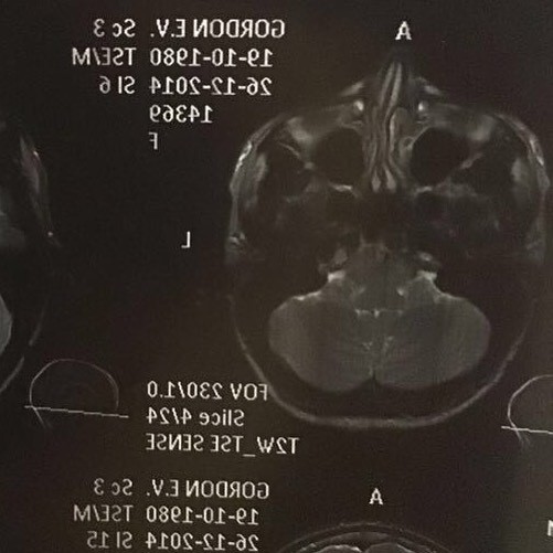Катя Гордон