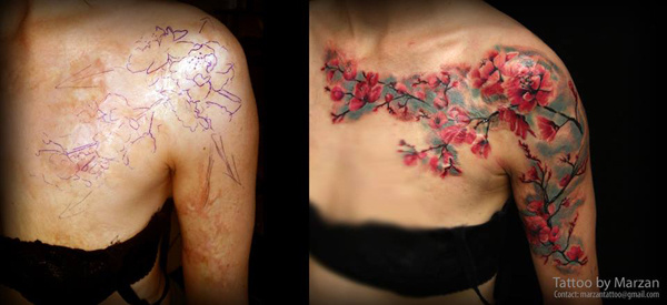 Татуировки вместо шрамов