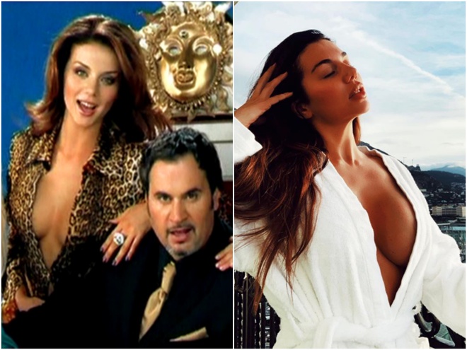 Анна Сєдокова до і після пластичних операцій