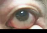 eye