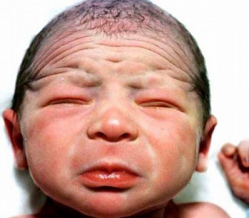 Страшненькие детки)